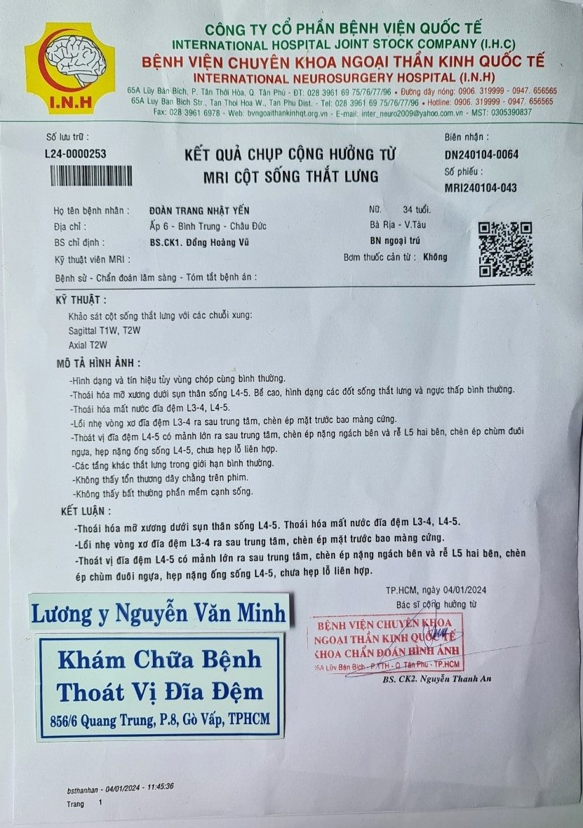 Thoát vị đĩa đệm chèn ép dây thần kinh